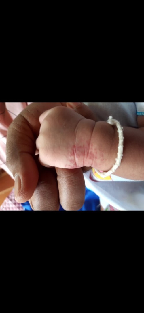 ปานแบบนี้อันตรายไหม