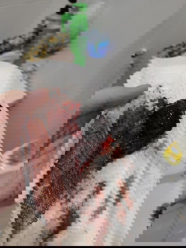 ผ่าคลอดมา14วันแล้วมีก้อนเลือดออกมาแบบนี้คืออะไรคะ