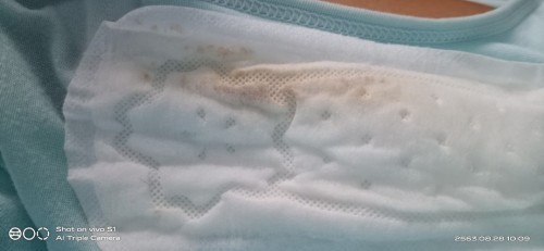 แม่ๆท่านไหนเคยเลือดไหลช่วง2เดือนแรกไหมค่ะ ของเราไหลมาเมื่อวานแบบแค่เปื้อนกระดาษแล้ว