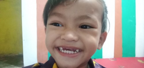 Kesehatan anak