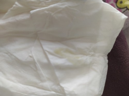 maaf bunda gambarnya jorok, apakah keputihan saya ini normal atau tidak? kehamilan 29weeks..