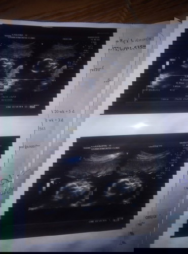 แบบนี้จะได้เพศไหนค้ะ