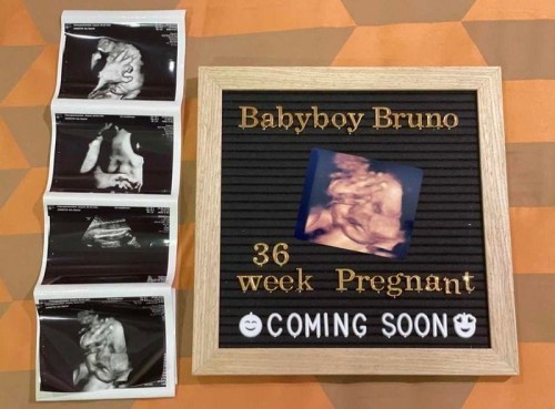 36weeks หนัก 3,200kg.