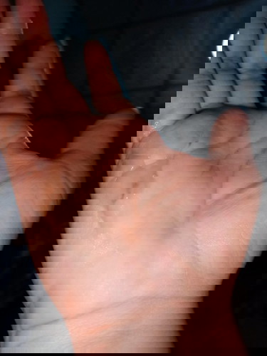 เป็นเเบบนี้อันตรายไหม