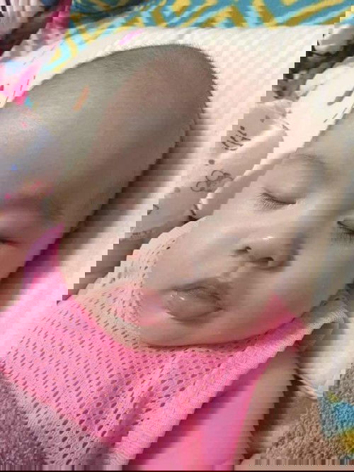 แม่ๆบ้านไหนผ่าคลอดบ้างคะ