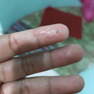 Keputihan or air ketuban?
