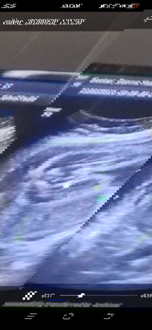 Lil bit confused if its a girl?