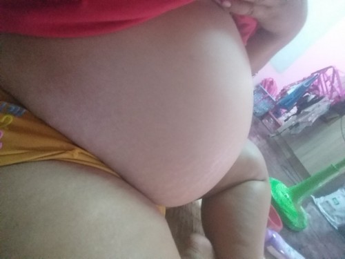 ปวดท้องปวดหลังปวดจิมิร้าวไปที่ก้น