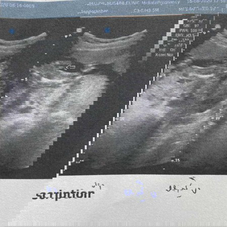 ขอเสียงคุณแม่ที่ได้ลูกสาวหน่อยค่ะ