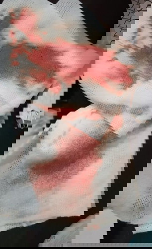 38 weeks pregnant bleeding