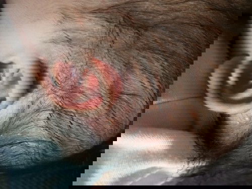 solusi obat cream atau apa yg bagus bun?