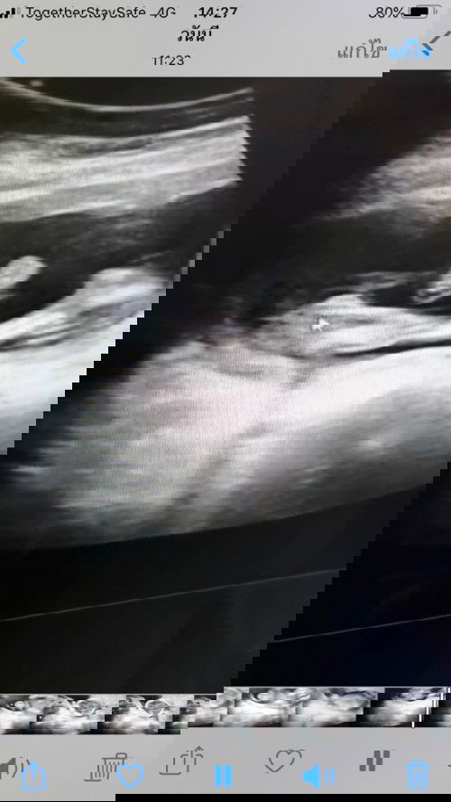 หญิงหรือชายคะ