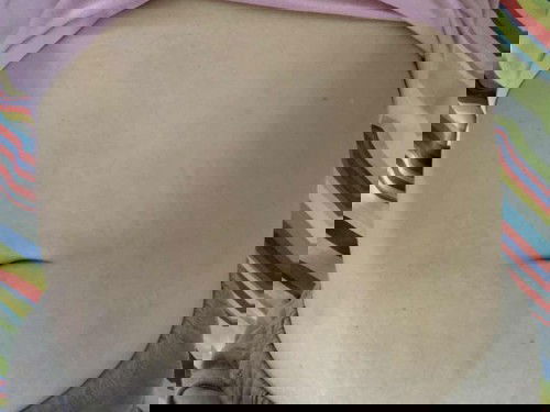 แม่ๆคนไหนท้องแตกลายบ้างไหมคะ