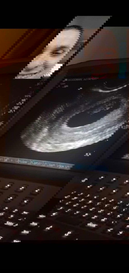 ครั้งแรกกับการอัลตราซาวด์