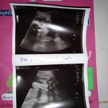 รูปนี้คือส่วนไหนของลูกค่ะ