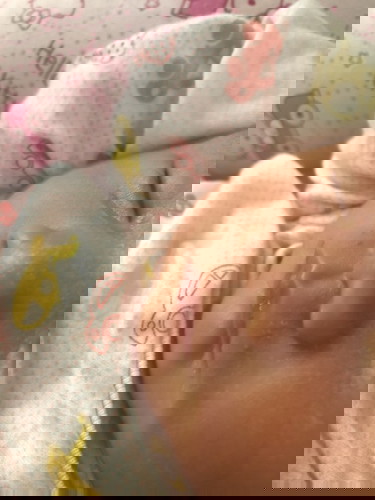 ลูกเป๊นแบบนี้ที่ปากค่ะ มีใครพอทราบไหมคะว่าลูกเป๊นอะไร