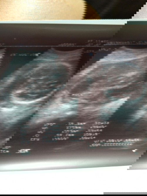 บ้านนี้ได้ลูกชายจ้าาา30วีค