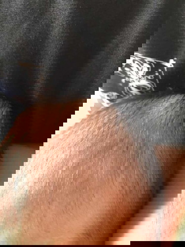 bayi 1 bulan ada benjolan dikepala