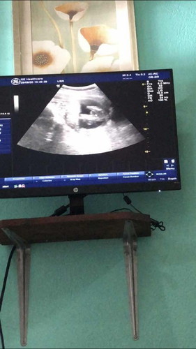 16 weeks 2 วัน หมอบอก 80% ผู้หญิงคะ