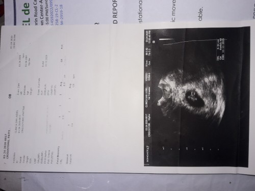 edd kung ano ang tamang duedate!