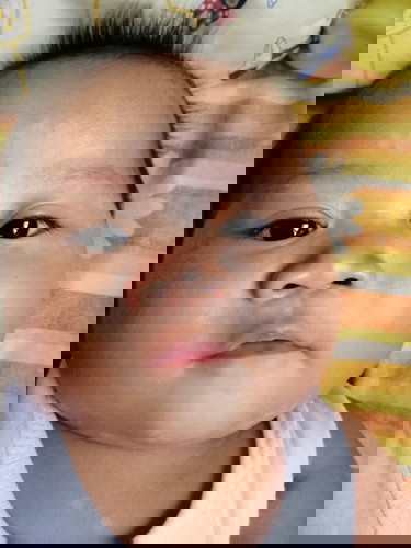 white marks