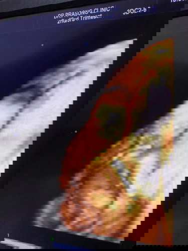 Babyboy จ้าา