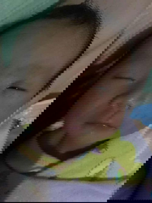 Muka anak umur 11 hari