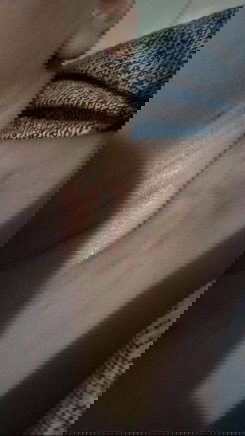 ruam antibiotik+salep