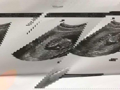 อยากทราบเพศลูก😍