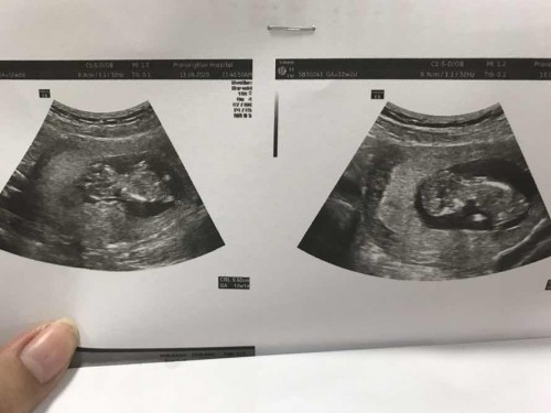 อยากทราบเพศลูก😍