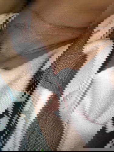 obatnya apa untuk bayi baru 27hari yang lehernya lecet :(