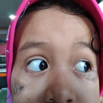 Kulit bersisik