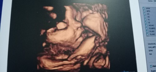 32+4วีค แล้วคับผม