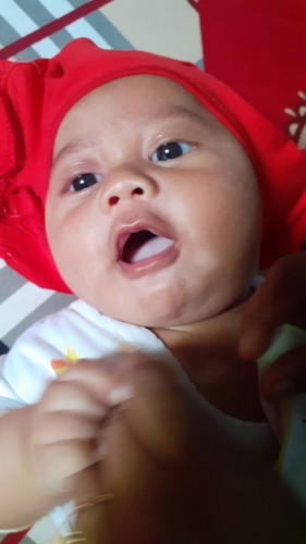 Di sebagian wajah, leher, siku, kaki, bagian punggung