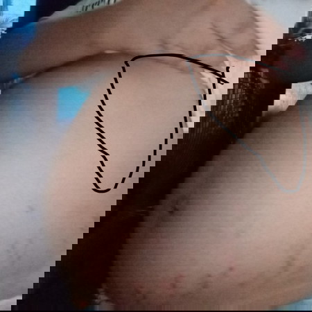 FTM