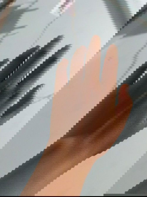 Jari-jari tangan terasa kaku dan sedikit bengkak