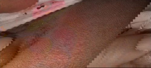 สอบถามแม่ๆหน่อยคะ