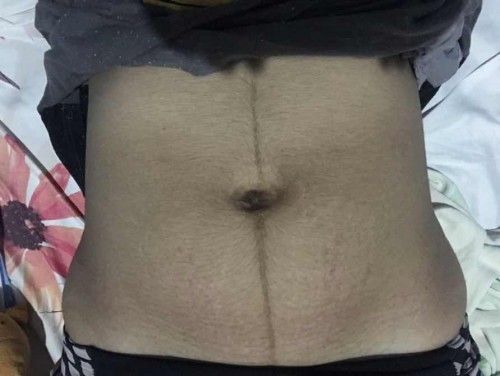 1 week after delivery