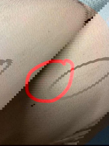 แบบนี้คือรอยแตกใช่มั้ยคะ