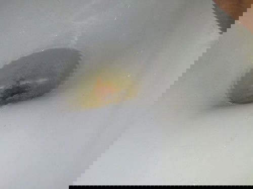 bab seperti lendir darah