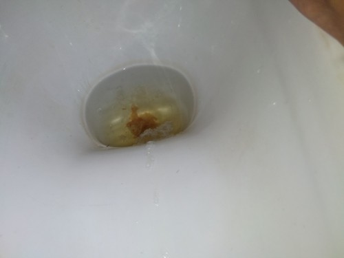 bab seperti lendir darah