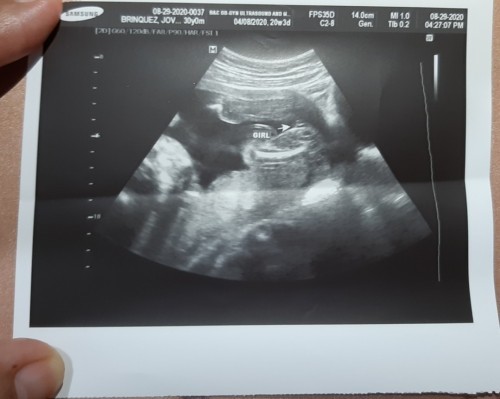 GENDER REVEAL