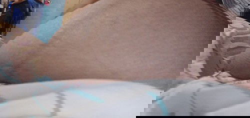 Masakit na ilalim ng tyan