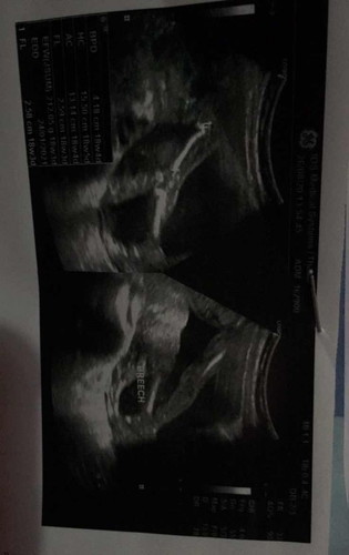 ท้อง 5 เดือน รู้เพศหรือยังคะ