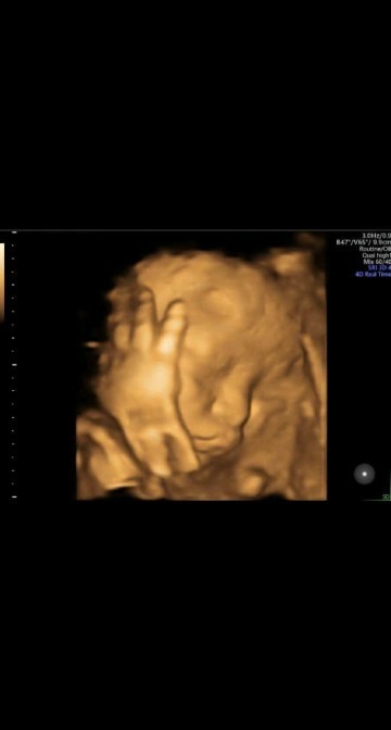 Alhamdulillah beby boy