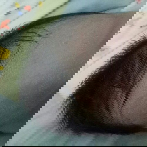 Ada bintik merah kaya jerawat. Terus dileher kaya ada kulit mau ngelupas