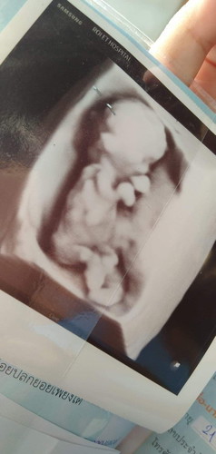 ถ้ายาที่หมอให้มาแล้วทานไม่ได้เลย ทานแล้วคืออ้วกออกหมดแล้วดื่มนมไม่ค่อยได้ควรทำไงคะ