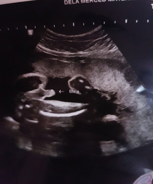 It's a Boy! 💗