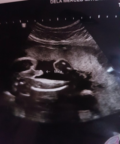 It's a Boy! 💗