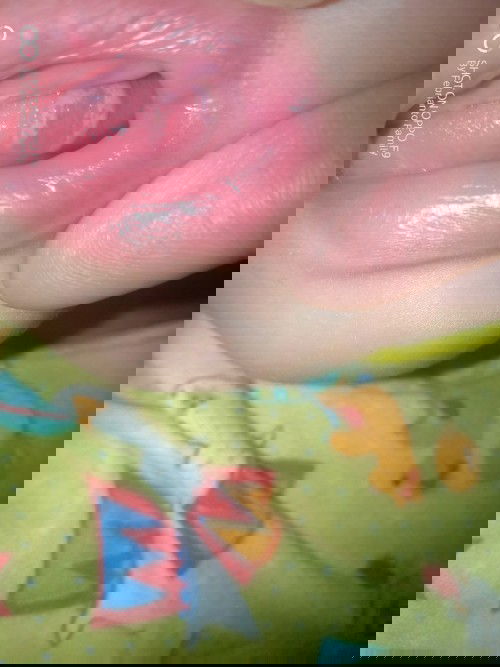 Lingkaran Putih Pada Lidah